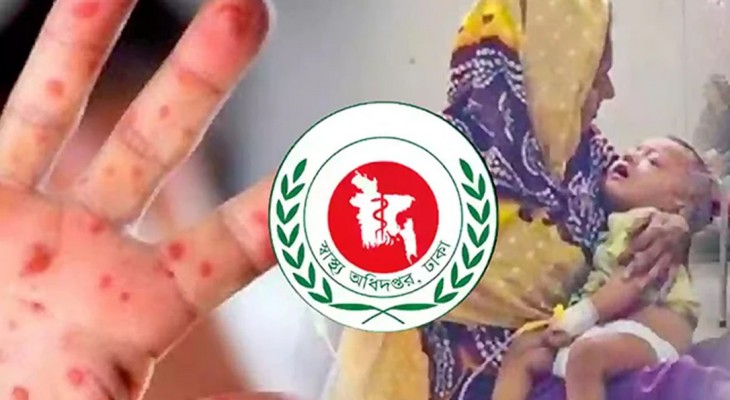 ২৪ ঘণ্টায় হাম এবং উপসর্গে আরও পাঁচ শিশুর মৃত্যু